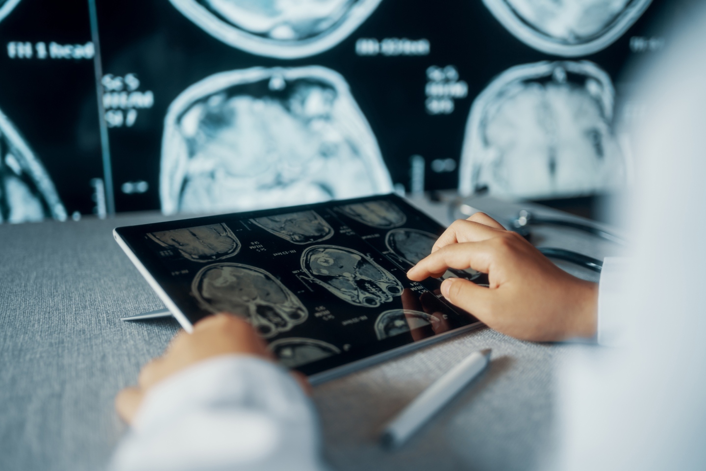 Person looking at X-Rays and medical imaging, representing Mach7